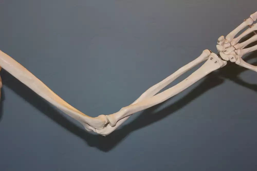 Artroskopie