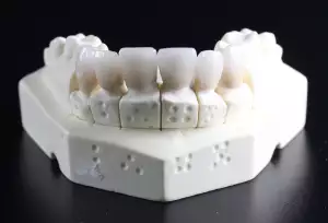 Zubní Protéza