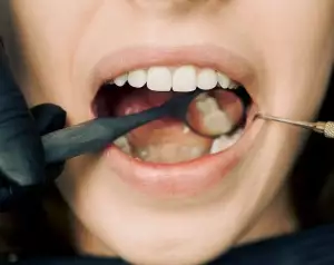 Zánět Zubu
